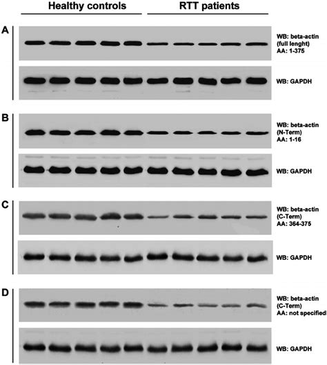 beta actin western blot